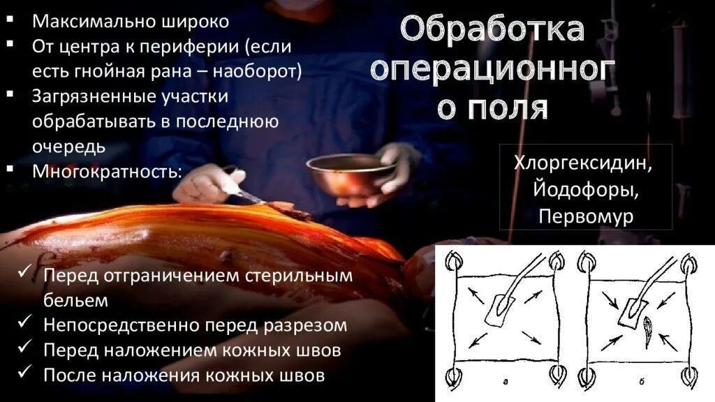 Алгоритм операционного поля. Обработка операционного поля. Обработка кожи операционного поля. Обработка операционного поля хирургия. Методы обработки операционного поля.