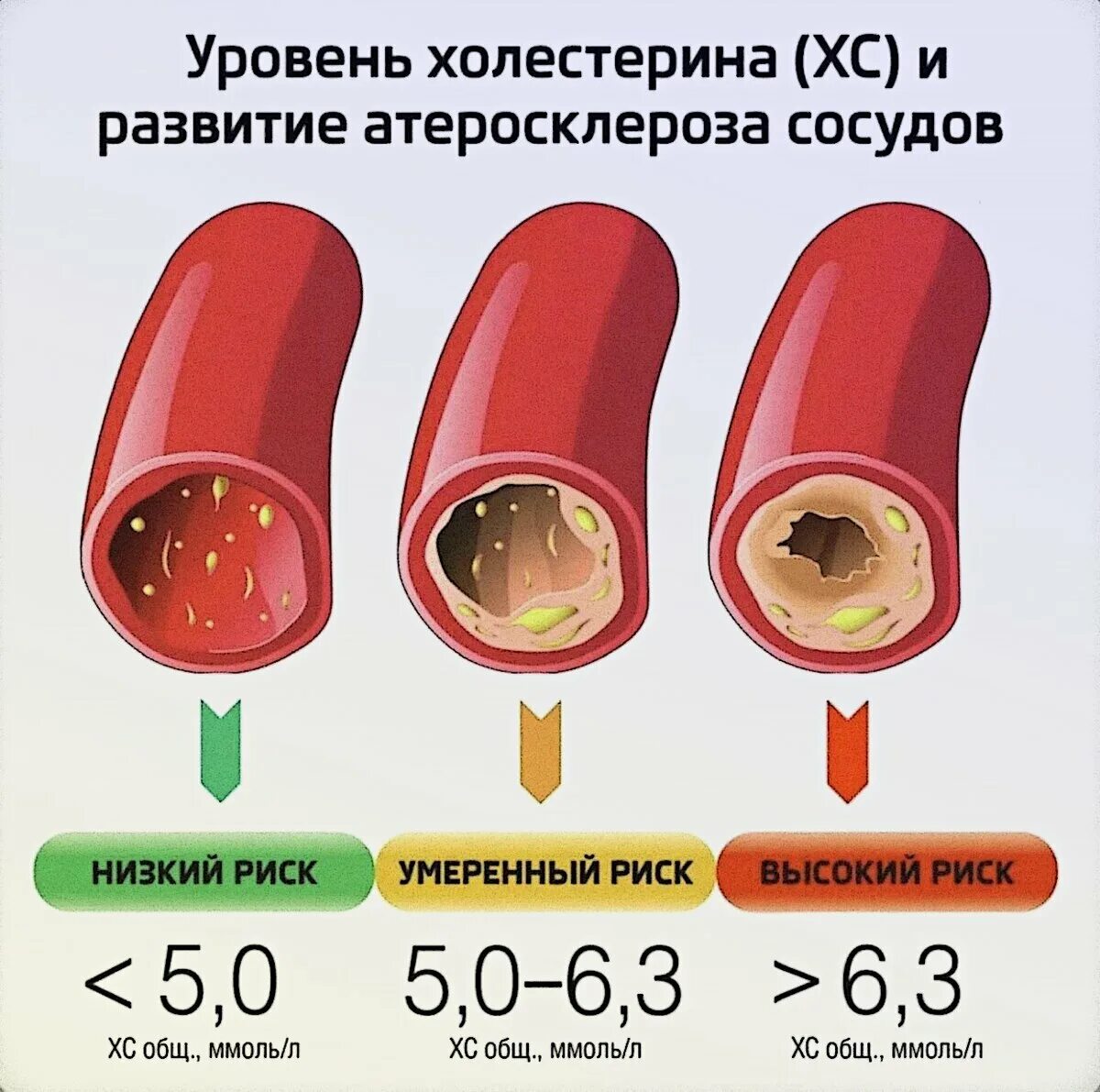Какой холестерин должен быть взрослого. Повышенный показатель холестерина в крови у женщин. кровь нормальные показатели холестерин в крови. снижение уровня холестерина в крови. нормальный уровень холестерола.
