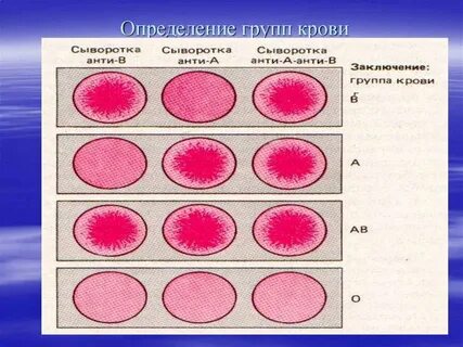 Как определить группу