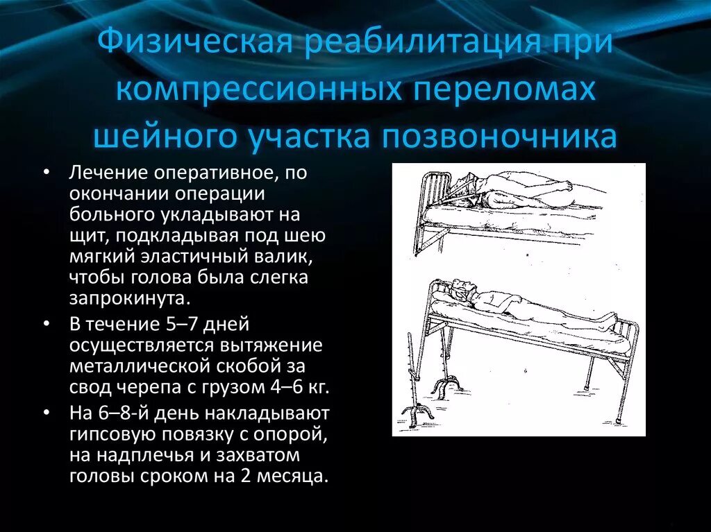 Перелом позвонка инвалидность. При компрессионном переломе позвоночника. реабилитация при компрессионном переломе позвоночника. физическая реабилитация при компрессионном переломе позвоночника. периоды реабилитации при переломах позвоночника.