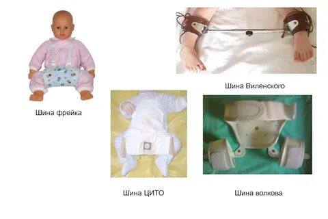 Дисплазия тазобедренного сустава шина
