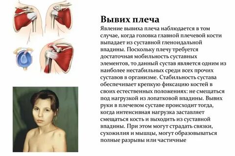 Вывих плеча симптомы у взрослого