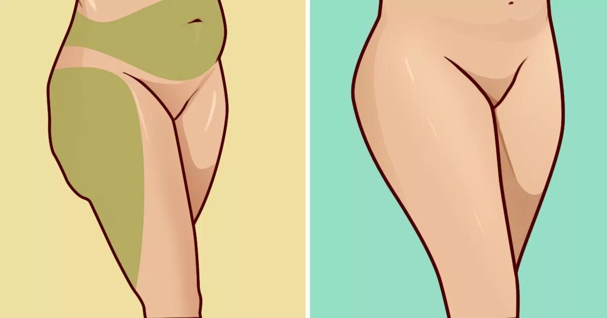 Thighs Hips различия. Hip thigh. Разница между Hip и thigh. Thigh Hip отличие.