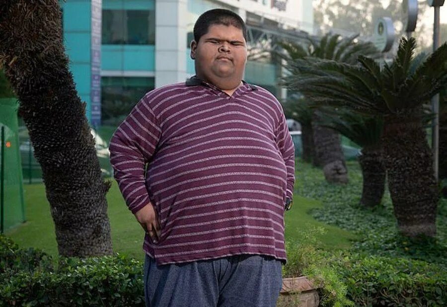 Самому толстому мальчику в. Арья пермана самый толстый человек в мире. Самый толстый мальчик арья пермана. Пакистанец мохаммед арбрар. Самый толстый мальчик в мире.