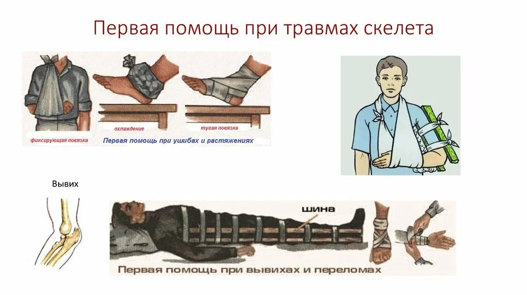 Первая помощь при повреждении скелета. Повреждения опорно-двигательного системы первая помощь при травмах. повреждения скелета и первая помощь 8 класс. первая помощь при травмах опорно-двигательной системы таблица. таблица первая помощь при повреждении опорно двигательной системы.