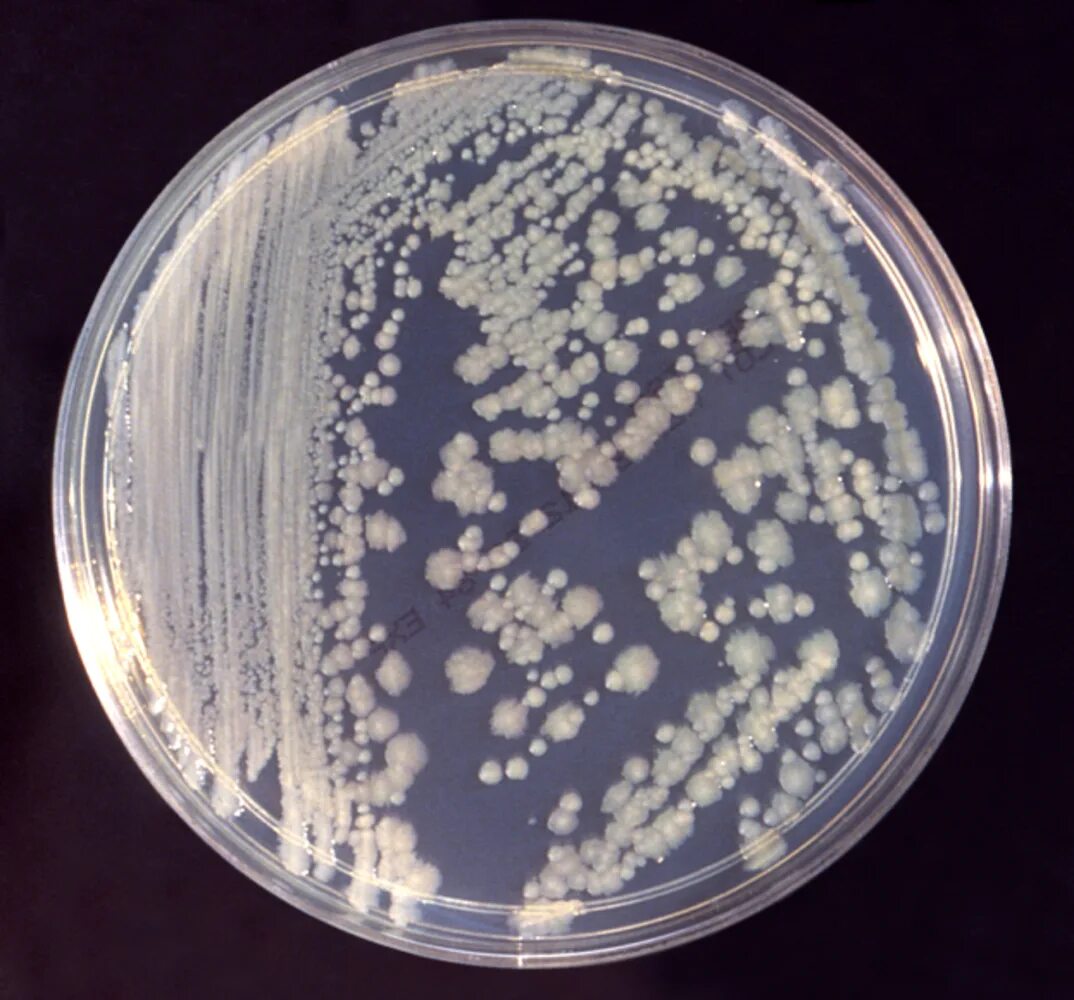 Энтеробактерии рода Enterobacter. Энтеробактер Аэрогенез. Энтеробактерии кишечная палочка. Чашка Петри энтеробактерии. Enterobacter cloacae что это