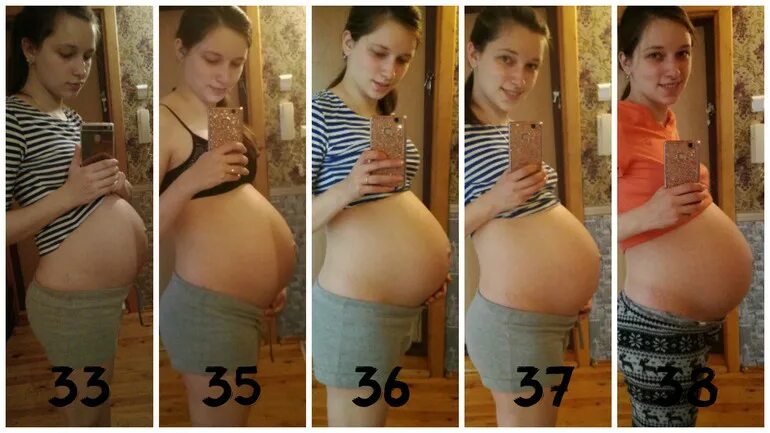 Тонус 33 недели. Отпусченный живот при беременности. Опущение живота перед родами. Опущенный живот перед родами. Опущение живота передбродами.