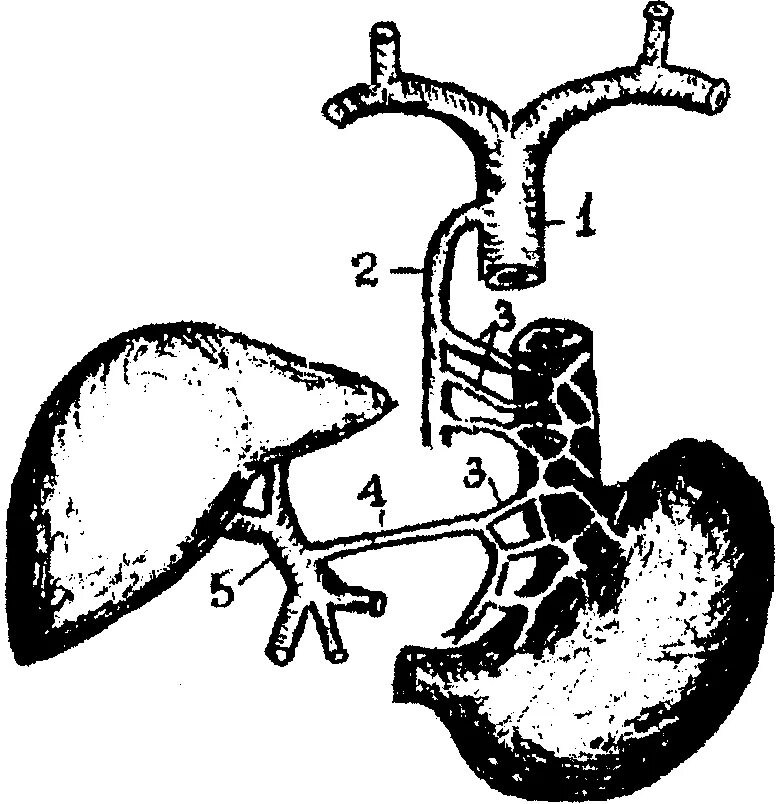 Портокавальные анастомозы печени. Портокавальные анастомозы пищевода. Портокавальные анастомозы желудка. Портокавальные анастомозы при портальной гипертензии.