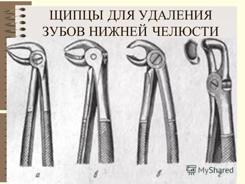 Щипцы прямые для удаления фронтальных зубов. Зубы удалять щипцами. Зубы удалять щипцами. Зубы удалять щипцами. Зубы удалять щипцами.