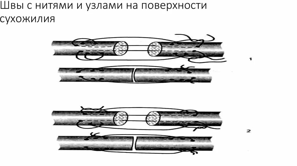 Способы уменьшения трения. Способы крепления капиллярного стержня в корпусе. Уплотнение движущихся деталей. Узлов поверхности. Узлов поверхности.