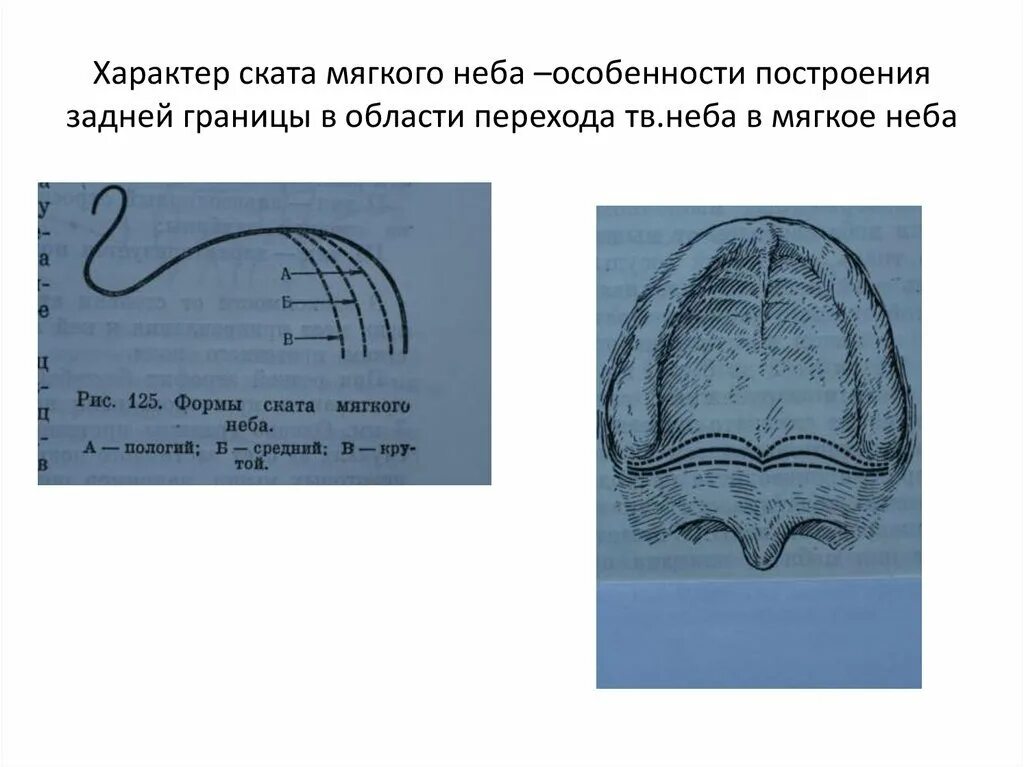 Разные формы твердого неба. Неба свод предложения