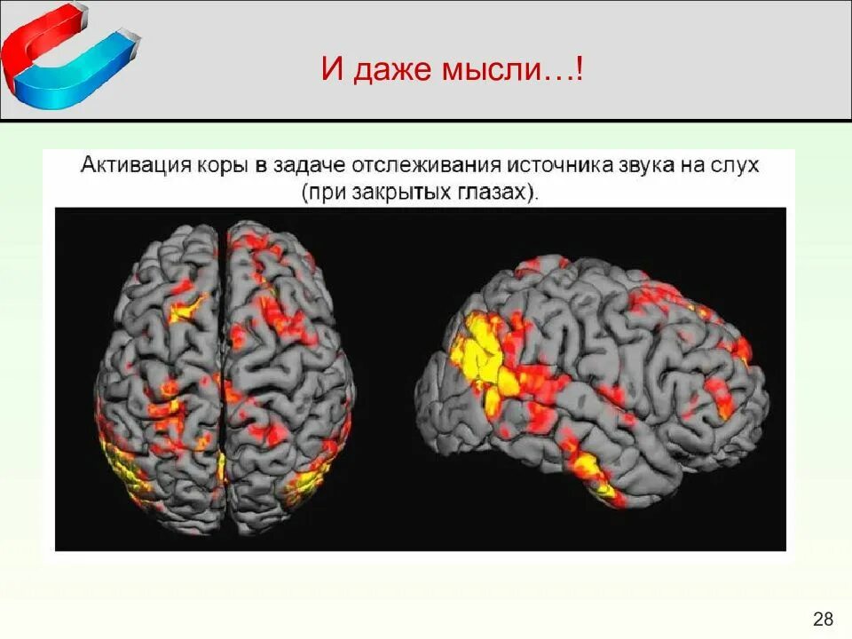 Мрт паническая атака. Магнито-резонансная томография головного мозга. Функциональное мрт головного мозга. Функциональная магнитно-резонансная томография. Функциональная мрт мозга.