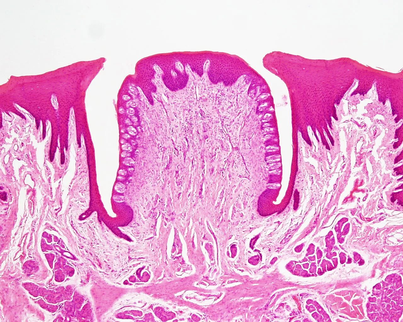 Желобоватый сосочек гистология. Желобовидные сосочки языка гистология. Желобоватый сосочек языка гистология препарат. Грибовидный сосочек гистология.