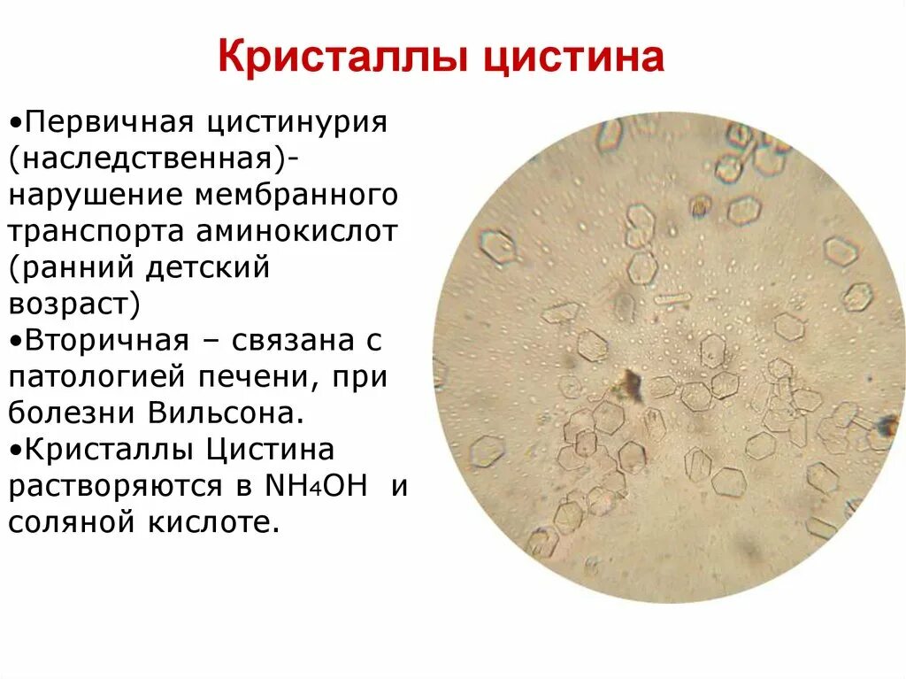 Повышен цистин в моче. Цистин микроскопия. Микроскопия неорганизованного осадка мочи. Микроскопия мочи. Кристаллы в моче.