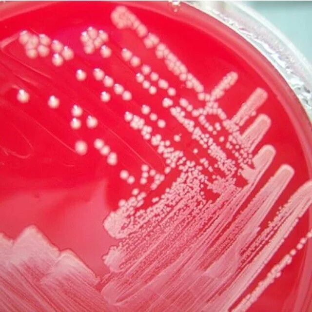 Acinetobacter baumannii микробиология. Acinetobacter calcoaceticus. Acinetobacter spp. Acinetobacter spp микробиология. Acinetobacter spp.