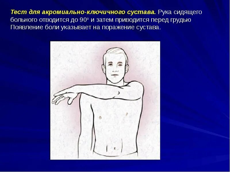 Грудино ключичная артрит. Акромиально ключичная проба. акррмиально клюяичная проба. аккремиально клбчичная проба. акромиально-ключичный сустав движения.