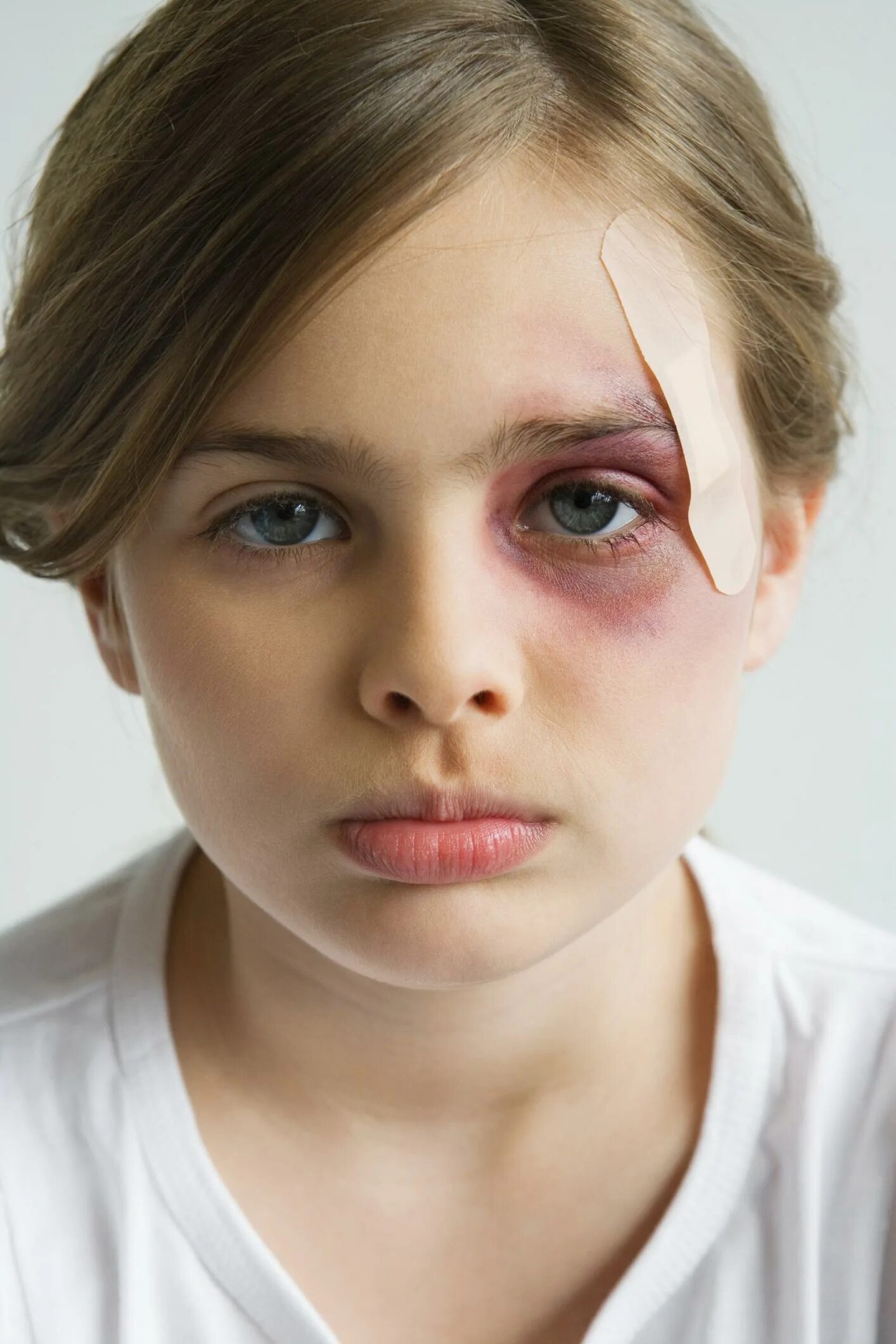 как нарисовать синяк под глазом