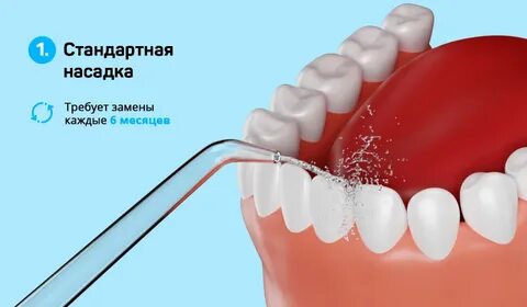 Чистка импланта
