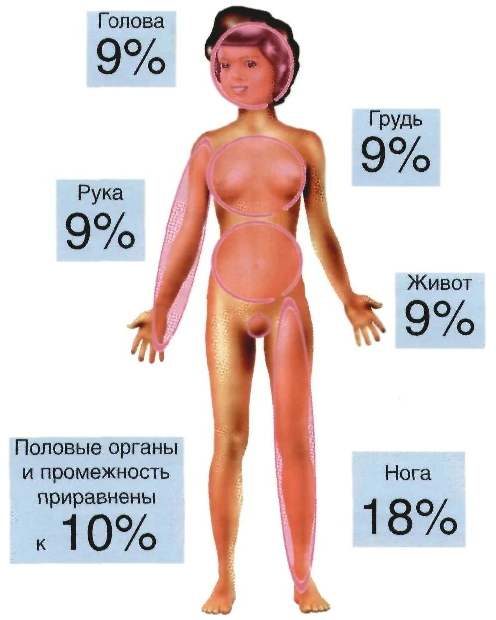 Ожоги проценты поражения