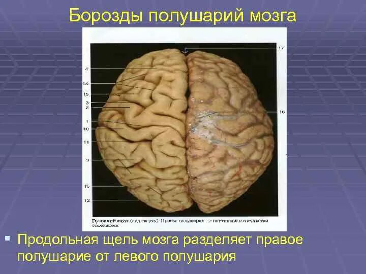 Полушарий мозга делятся. Борозды мозга. Борозды полушарий. Поперечная щель большого мозга. Продольная борозда мозга.