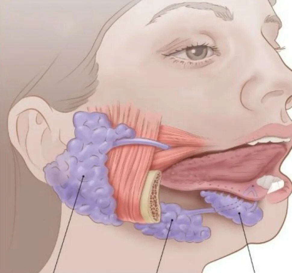 Увеличение околоушной железы. Сиалоаденит слюнной железы. Сиалоаденит околоушной железы. Калликреин слюнные железы. Слюнные железы под языком.