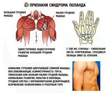 Сокращение мышц в грудной клетке
