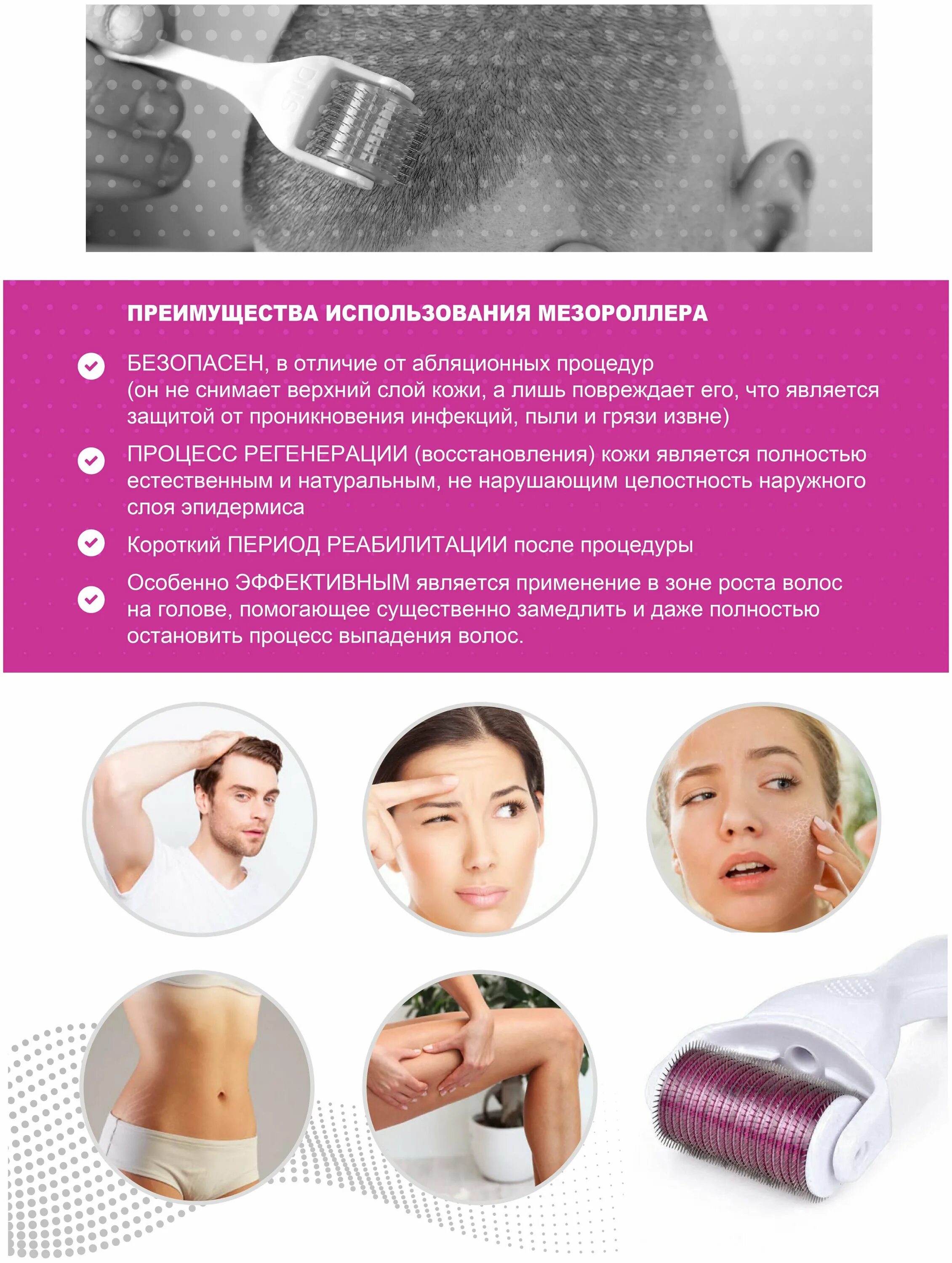 мезороллер для лица какие иглы