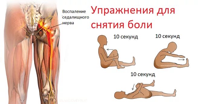 Ущемление тазобедренного сустава