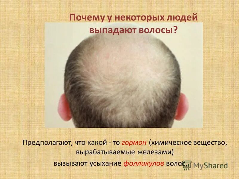 почему у человека выпадают волосы. выпадение волос. выпадение волос у мужчин. поредение волос у мужчин. почему у человека выпадают волосы.