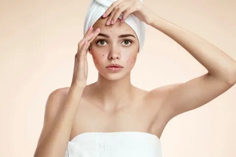 Acne removing
