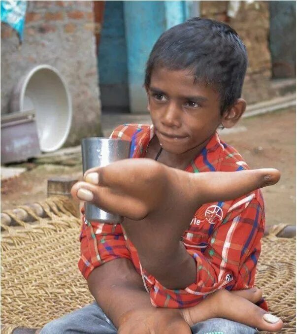 Маленький индийский мальчик. Индийский мальчик с гигантскими руками. Большое яичко мальчик