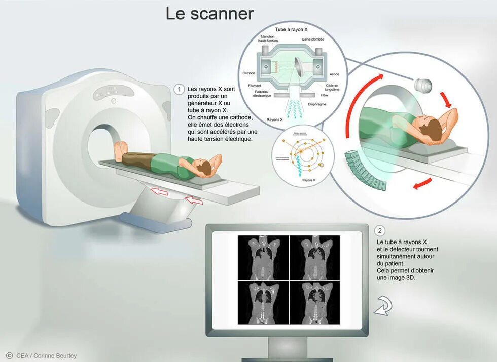 Scanner на русском. Scanner-le. imagerie medicale перевести с французского. tube scan. tube scanner studio software.