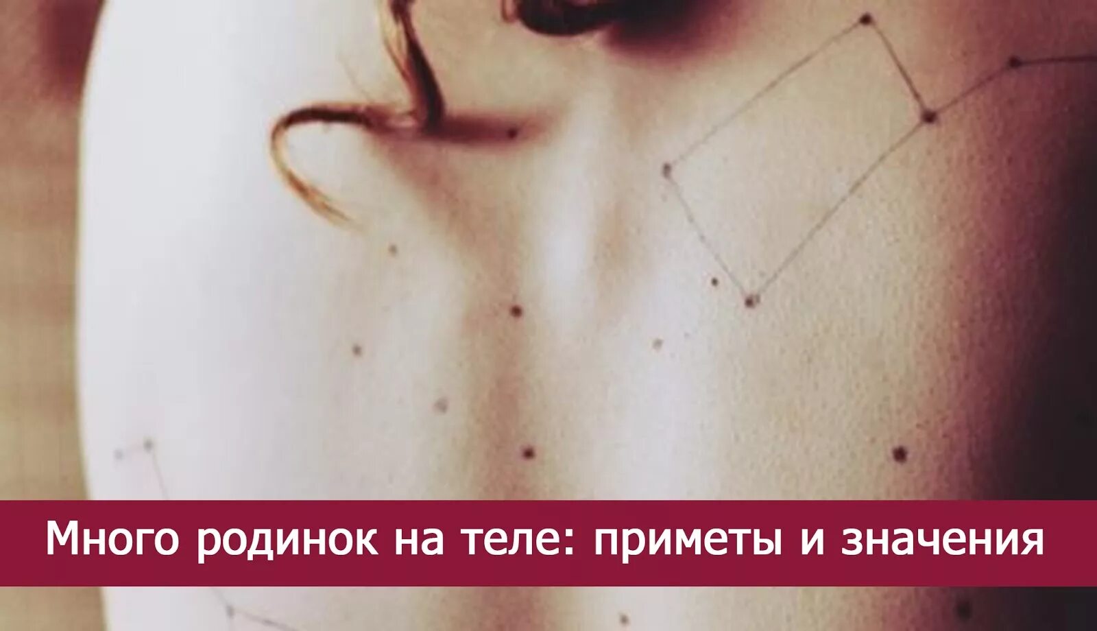 Что означает много родинок на теле