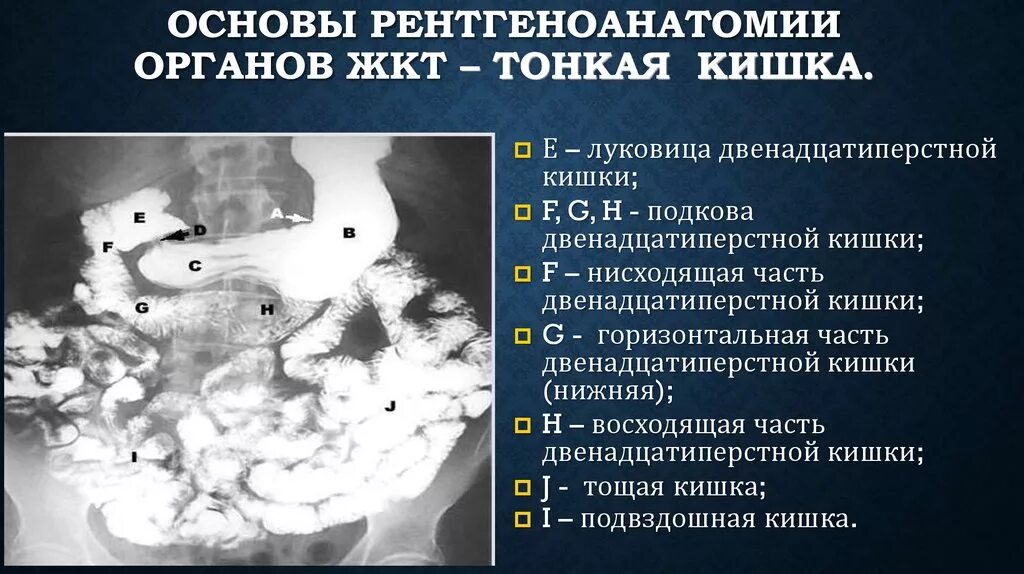 Инородное тело брюшной полости после операции. Рентген анатомия тонкого кишечника. Рентген тонкого кишечник норма. Рентгенологическое исследование двенадцатиперстной кишки. Рентренанатопия топкой кишки.