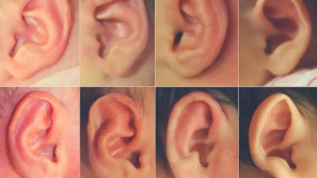 Что означает мочка уха. Точки на ушах. Строение мочки уха человека. Что означает мочка уха. Мочка ушной раковины анатомия.