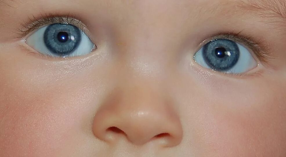 Baby eye песня. Легкое косоглазие. Легкое косоглазие у ребенка. Вертикальный страбизм.