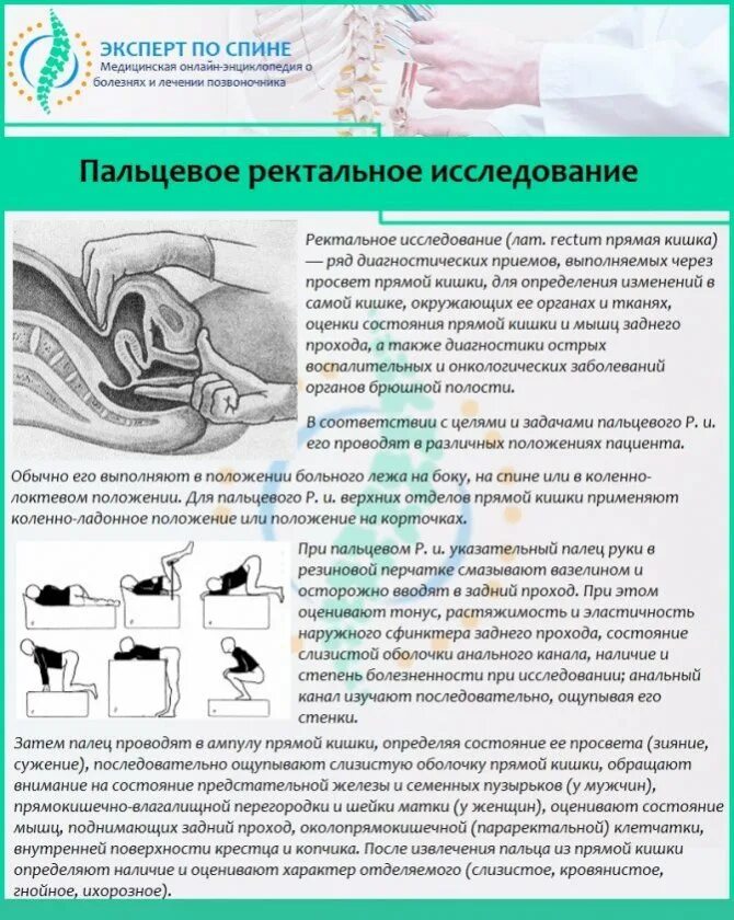 Ощущение в прямой кишке. Пальцевое обследование прямой кишки алгоритм. Пальцевое ректальное исследование. Пальцевое ректальное исследование предстательной железы. Палцевое исследованиепрямой кишки.