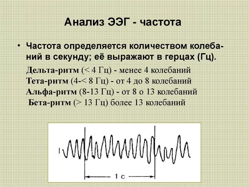 Частота ээг