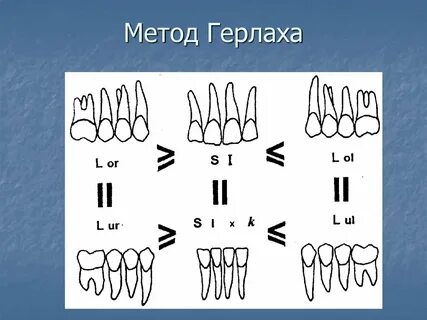 Верхний тон