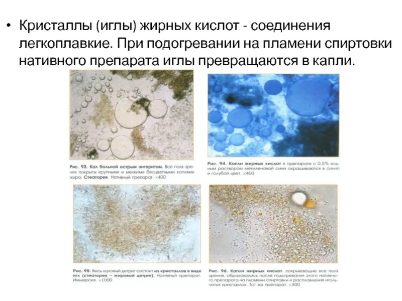 Мышечные волокна в кале причины. Биологические функции нейтральных жиров. Соли жирных кислот в кале под микроскопом. Много крахмала в кале у ребенка причины. Внеклеточный крахмал в кале.