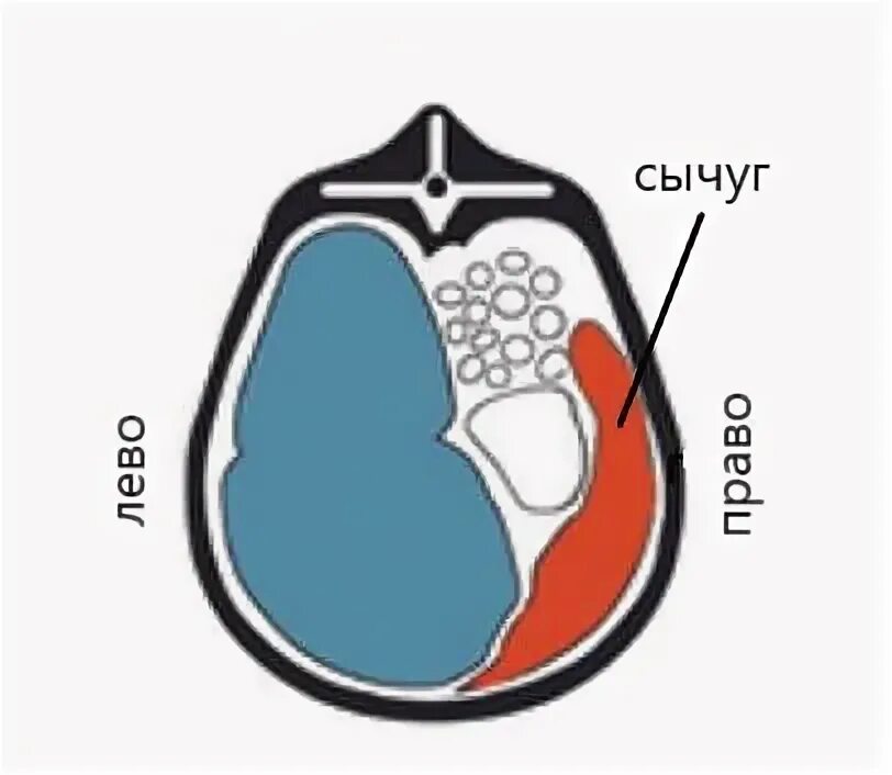 Смещение сычуга у коров. Правостороннее смещение сычуга. Правостороннее смещение сычуга. Левостороннее смещение сычуга у коров. Смещение сычуга у коров.