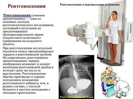 Рентген желудка с барием как делают