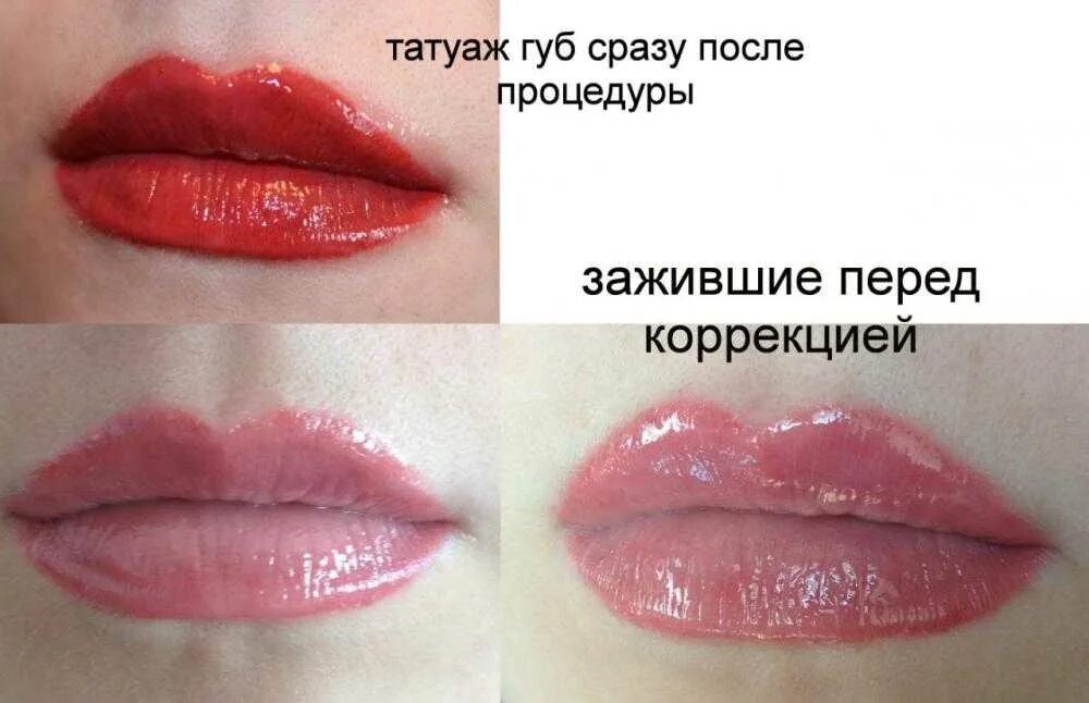 Перманентный макияж губ. Перманентный макияж губ заживление. Перманентный макияж губ до и после. Татуаж губ после заживления. Заживление перманентного макияжа губ по дням фото