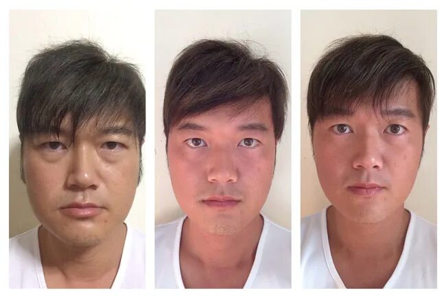 женщина до и после курения. курил до и после. внешность до и после курения. внешность до и после курения. люди бросившие курить фото до и после.