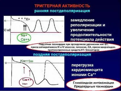 Пируэтная тахикардия