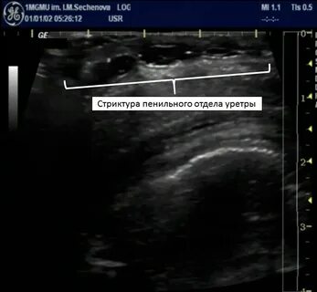 Где находится уретра