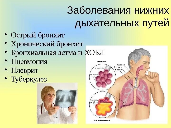 Хронические респираторные заболевания. Заболевания дыхательных путей. Профилактика хронических болезней нижних дыхательных путей. Заболевания верхних дыхательных путей. Респираторные инфекции нижних дыхательных путей.