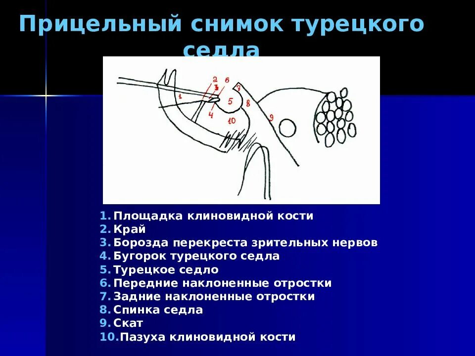 Спинка турецкого седла. Бугорок турецкого седла. бугорок турецкого седла анатомия. рентгеноанатомия турецкого седла. скат турецкого седла.