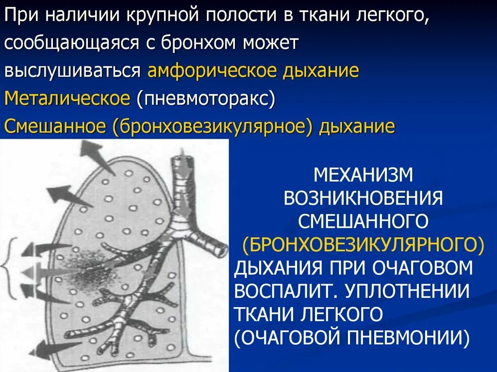 Образование полостей в легких