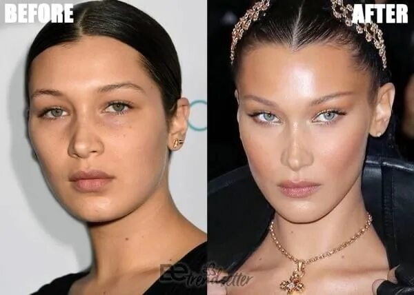 Bella Hadid nose job: Before and after photos The Sun